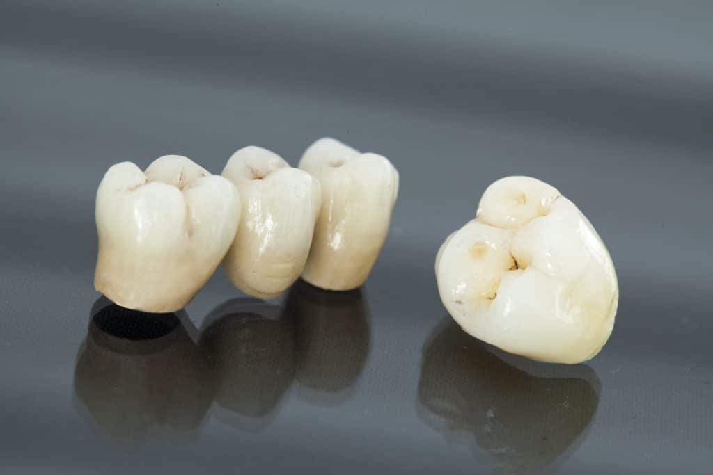 Dental Crowns Dallas