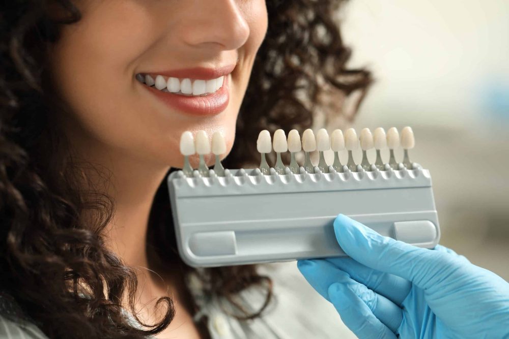 Dental Veneers in Dallas